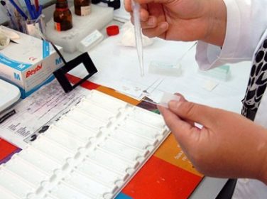 Lüleburgaz’da Ücretsiz Kanser Taraması